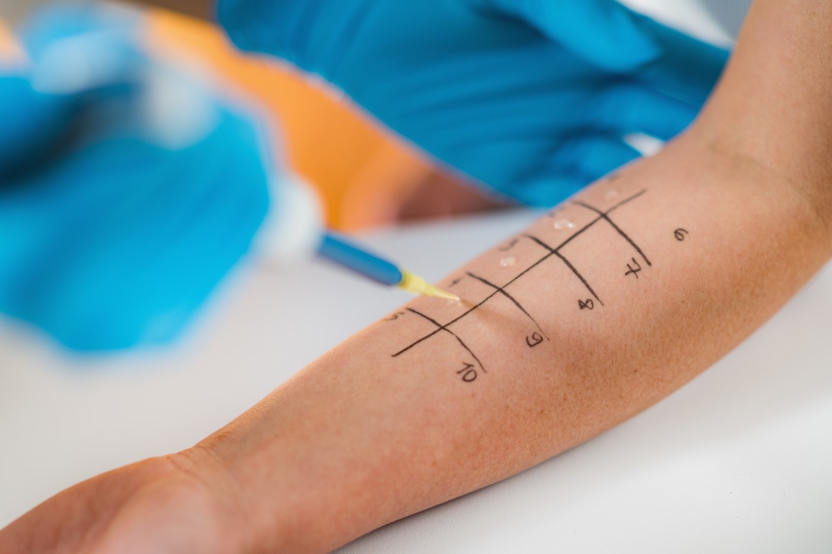 Alergología · Clínica Salak Pelvicare